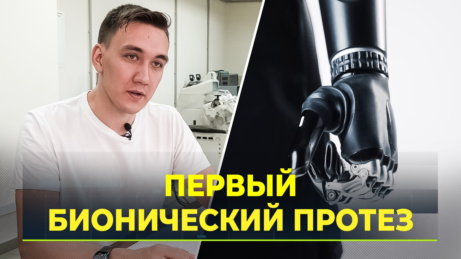 В Тюмени разрабатывают первый в стране бионический протез пальца