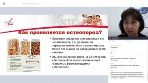 Остеопороз - лекция врача Галины Костиной