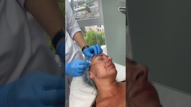 Обучение биоревитализация _разметка на модели для введения канюли смотреть онлайн