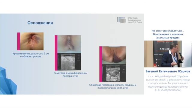 Осложнения лечения анальной трещины