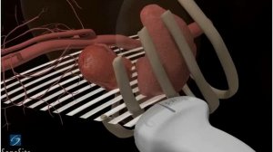 3D-пособие: Ультразвуковое исследование левой почки -- ультразвуковая система SonoSite