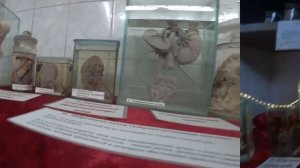 Коллекция Уродов Кунсткамера Музей Медецины И Греха Жуткая Выставка