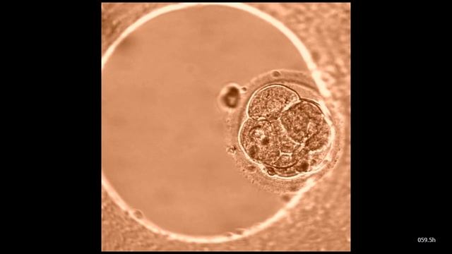 Развитие_эмбриона_с_момента_оплодотворения_in_vitro_и_до_5-6_дня_развития.mp4