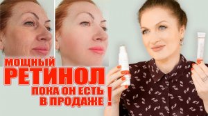 Ретинол и мощным  эффектом  и пока еще его можно купить! И как правильно и безопасно применять!