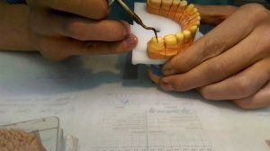 Wax Up Моделирование зубов воском 1
