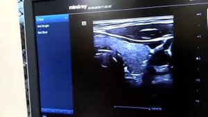 Сравнение изображений Mindray DC8 и Mindray DC 70