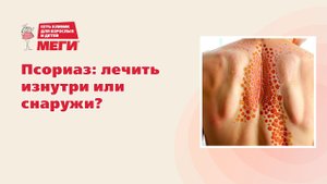 Псориаз: лечить изнутри или снаружи?