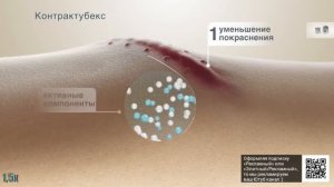 Контрактубекс — «Лечение шрамов в свои руки» в 8х быстрее | PRO Рекламу