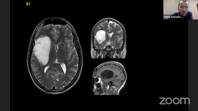 Rhoton Neuroanatomy Module IV - Exploring the Brain Session I