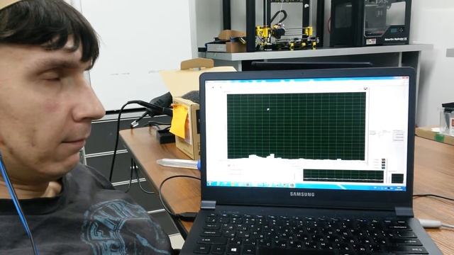 ЭЭГ регистрация альфа-ритма при расслаблении смотреть онлайн
