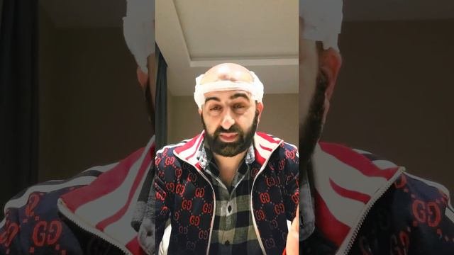 ПЕРЕСАДКА ВОЛОС ОТЗЫВ
