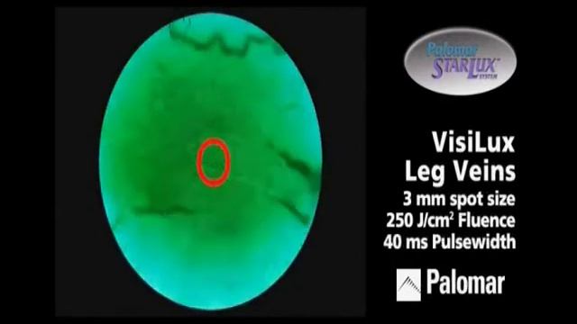 Palomar лазер Паломар смотреть онлайн