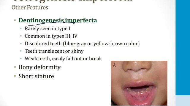 Клеточная биология USMLE - 3. Клеточная биология - 4.Соединительная ткань