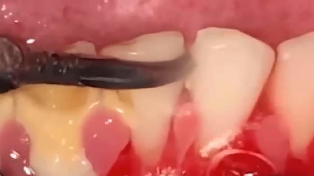 Personal Care and Oral Health смотреть онлайн