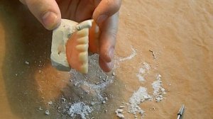 ЗУБНЫЕ ПРОТЕЗЫ-как"прицепить крючок"