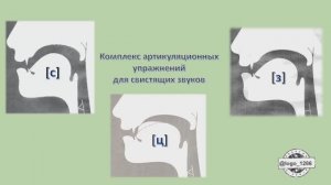 Комплекс артикуляционных упражнений для свистящих звуков.