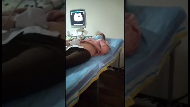 Как мы узнали что у нас будет двойня! Первое УЗИ. Реакция мужа на многоплодную беременность. смотреть онлайн