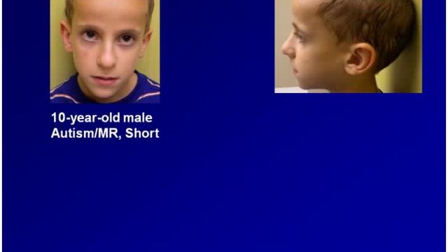 Genetics of Autism From Chromosomes to Mitochondria.flv смотреть онлайн