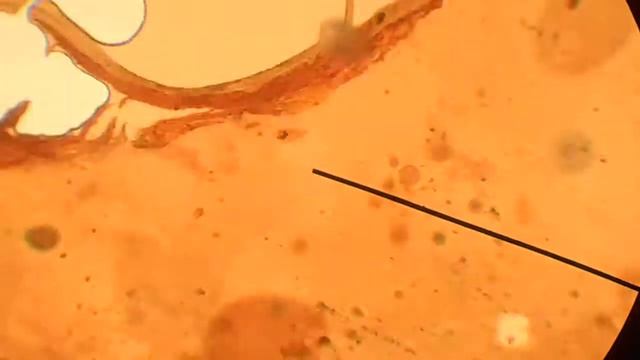 123 Корень зуба/поперечный разрез/ смотреть онлайн