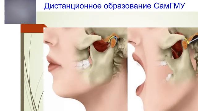 Лекция Савельева А.Л. Ошибки и осложнения операции удаления зуба