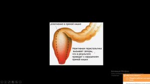 Перистальтика