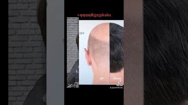 Таджикистан Душанбе система интеграция волос . Парик Мужские и женские. Доставка по Центральной Азии