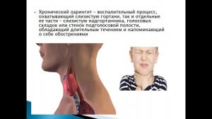 ларингит