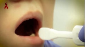 Слюновой экспресс-тест на ВИЧ