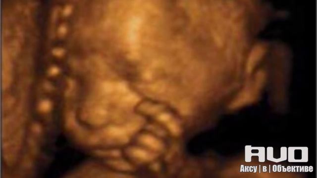 AVO ~ Рекомендует! Проблема абортов смотреть онлайн