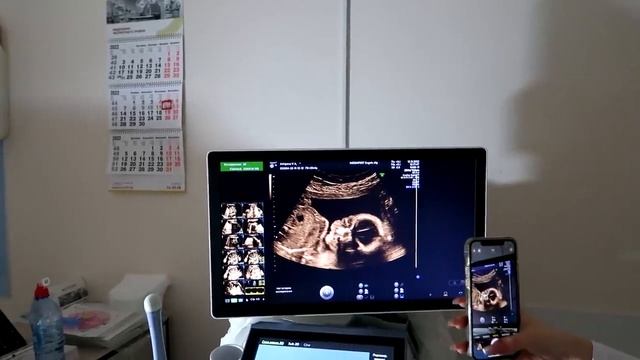 ВЛОГ:ВТОРОЙ СКРИНИНГ,СНОВА ПЕРЕЕЗД смотреть онлайн