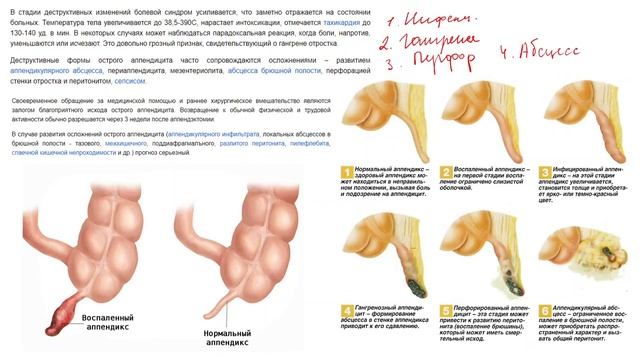 Патологическая анатомия | ПИЩЕВАРИТЕЛЬНАЯ СИСТЕМА. Гастрит. Цирроз. Гепатит.