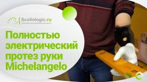 Бионический протез с кистью Michelangelo для Василия