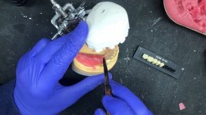 Ацеталовый протез | Protesis flexbiles acetal