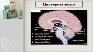 КТ анатомия головного мозга. Андрей Мангов.mp4