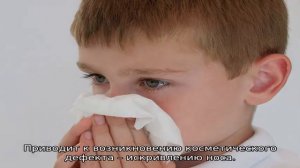 Признаки перелома носа у ребенка — как определить перелом