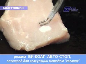 Демонстрация режима: "БиКоаг Автостоп"