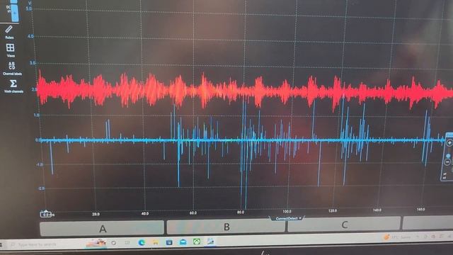 Toyota Landcruiser Code 52 Knock Sensor смотреть онлайн