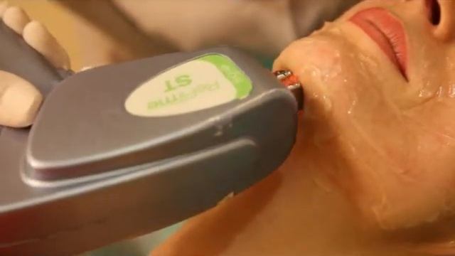 Cherry ELOS омоложение и эпиляция смотреть онлайн