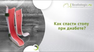 Стопа Шарко, или диабетическая стопа_ разгрузить и сохранить