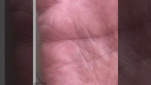 Вдовство по линии Брака?