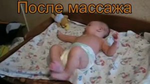 Мышечная дистония до и после массажа