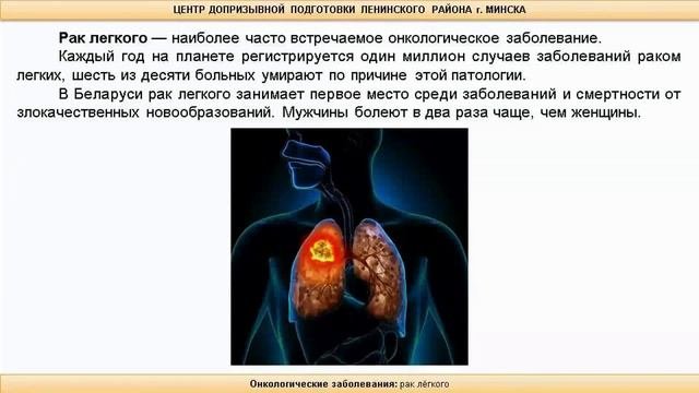 Тема 16. Онкологические заболевания: рак молочной железы, рак лёгкого и рак желудка