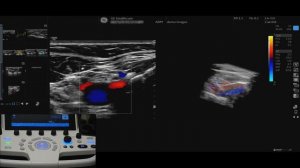LOGIQ P9 Tutorials: 3D Capabilities