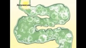 Эспумизан для детей
