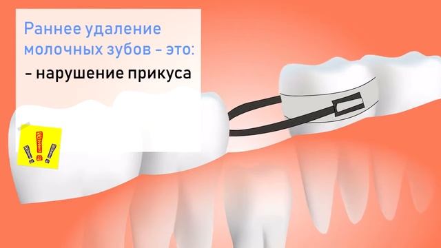 Лечить или удалять молочные зубы? смотреть онлайн