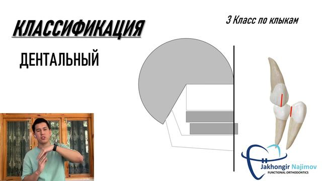 ПЛАН ЛЕЧЕНИЯ ПРОГЕНИИ | 3 КЛАСС