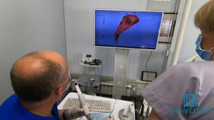 3-D сканирование ротовой полости! Как это работает?