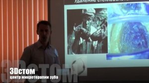 Перелечивание. Удаление штифтов.