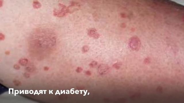 GMP риск №3. ХАССП и ISO 22000. Производство пищевой продукции. Приемка сырья и материалов.Пестицид смотреть онлайн