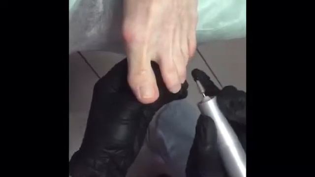 Аппаратный педикюр